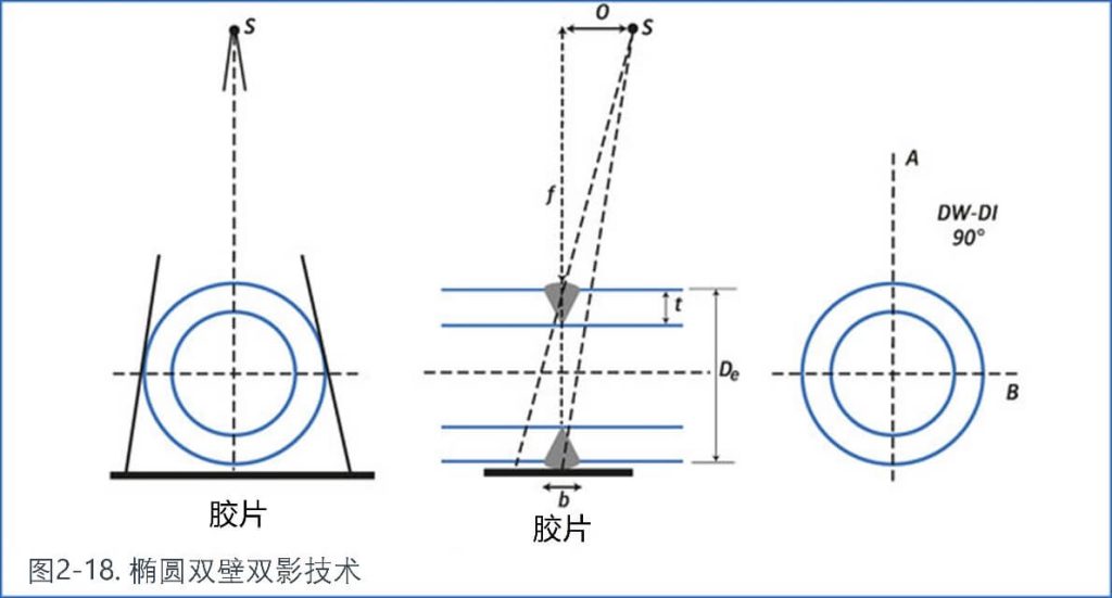 圓雙壁雙影技術(shù)